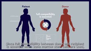 Companiile de recoltare celule stem prezente pe piata romaneasca proceseaza si stocheaza celulele stem fie in tara, in locatii proprii, fie in strainatate, in tara specificata in tabel. Lifeline Romania Banca Ta De Celule Stem 3 Produse De Terapie CelularÄ