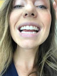 Redmondortho Accessibility Statement, 12819 120th Ave NE, Kirkland, WA  98034, US