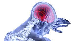 La esclerosis lateral amiotrófica (ela) es una enfermedad del sistema nervioso central caracterizada por una degeneración progresiva de las neu­ ronas motoras en la corteza cerebral. Que Es La Ela Causas Y Sintomas De La Esclerosis Lateral Amiotrofica