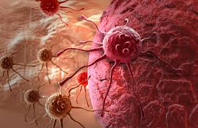 Resultado de imagen para metastasis