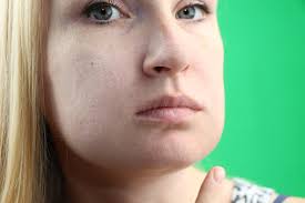 Vấn Đề Về Răng Gumboil Thông Lượng Và Sưng Má Cận Cảnh Cô Gái Buồn Xinh Đẹp  Bị Đau Răng Mạnh Phụ Nữ Hấp Dẫn Cảm Thấy Đau Răng Sức Khỏe Răng Miệng Và  Khái Niệm Chăm Sóc Hình ảnh Sẵn có