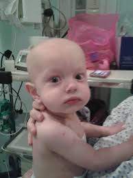 Fundraiser by Alex Brito Sag : Help little Liam beat cancer