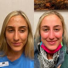 Dr. Matthew Innes Dermatology