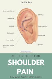 Pin On Acupuncture Acupressure For Everyone