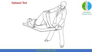 Image result for Galeazzi Sign