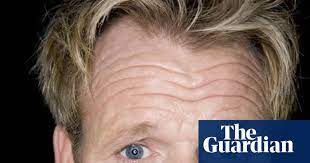 Say goodbye to hair loss in 2021. Hair Apparent How Transplants Are Beating Baldness Men S Health The Guardian