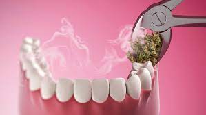 Smoking Weed After Wisdom Teeth Removal
