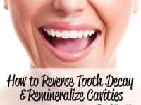 So how can you reverse cavities naturally? How To Remineralize Teeth Naturally Wellness Mama