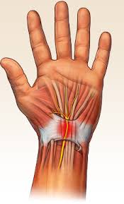 Image result for karp ln  tunel ort za