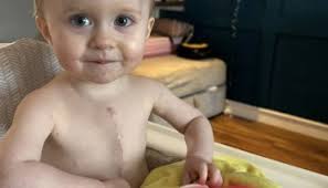 Tetralogy of Fallot (TOF): Iris' Story