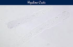 images?q=tbn:ANd9GcTnJCMCcfsPmoKZtWH_QNDkwNkKsDXW4pfpRQ&s