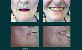 We did not find results for: Same Day Dentures