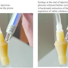If the process takes less than 15 minutes, it is injection. Saline Solution Re Aspiration After Intravenous Injection Through The Download Scientific Diagram