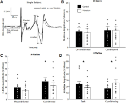 Usually considered a pathological reflex in a clinical setting, the hoffmann's reflex has also been used as a measure of spinal reflex processing in response to exercise training. Indirect Vibration Of The Upper Limbs Alters Transmission Along Spinal But Not Corticospinal Pathways Biorxiv