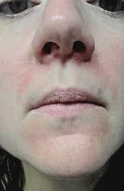 Can someone help me so I can get more moisturizer... $Jeffc208 Cash app