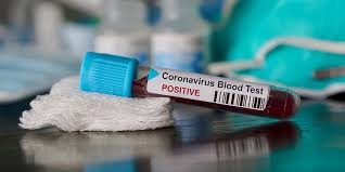 Spread the facts, not the virus. Covid 19 And Amr What Do We Know So Far 2020 React