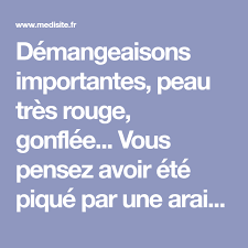 Piqures D Araignee 7 Remedes Pour Etre Vite Soulage Piqure Araignee Demangeaison Remede