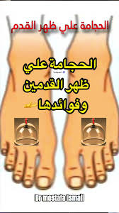 الحجامة على ظهر القديمين وفوائدها