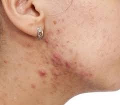 Pin On Skin Care