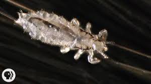 This hair stacks beautifully to make tails, tail brushes, and will also spin to tie steelhead skaters and to provide bulk under materials like ostrich. How Lice Turn Your Hair Into Their Jungle Gym Deep Look Youtube