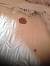 Period Blood On Bedsheet