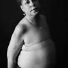 The normal breast is made of tiny tubes (ducts) that end in a group of sacs (lobules). 1