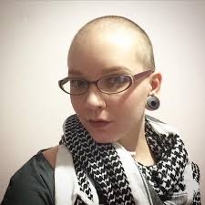 A 30 éves Allyson Lynch modellkarriert futott be, miután mellrákkal  diagnosztizálták