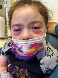 Sicilee's CF Journey