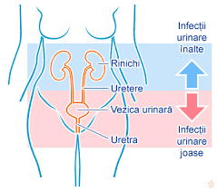 Infectia Urinara