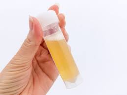 Maybe you would like to learn more about one of these? Frothy Urine Could It Be A Sign Of Kidney Disease On World Kidney Day Learn More About The Early Warning Signs And Symptoms Of Ckd Health Tips And News