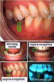 Dr Jeffrey Dorfman Dentist