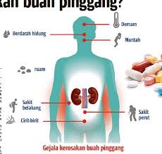 Sakit buah pinggang kronik bermaksud terdapat penurunan yang banyak dalam fungsi buah pinggang. Makanan Tambahan Punca Kerosakan Buah Pinggang Pressreader