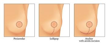 Pin On Plastic Surgery
