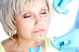 Rafael camberos is a top plastic surgeon in tijuana, mexico. Mexico Cosmetic Center 1 Plastic Surgery In Tijuana Mexico