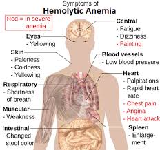 Image result for Indirect Coombs