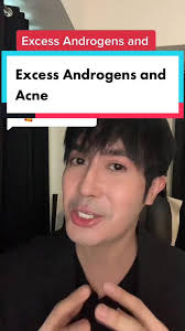 Excess Androgens and Acne: Understanding the Role of Testosterone