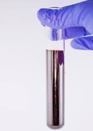 Also known as activated partial thromboplastin time (aptt)) is a screening test that helps evaluate a person's ability to appropriately form blood clots. Difference Between Aptt And Ptt Compare The Difference Between Similar Terms