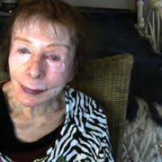 DOUGLAS CHIN, MD, FACS