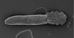 Image result for Demodex folliculorum