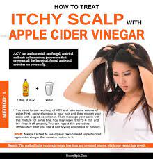Check out the methods of using apple cider vinegar for hair loss right here. How To Use Apple Cider Vinegar For Itchy Scalp Dandruff Relief Dandruff Remedy Apple Cider Dry Itchy Scalp Dry Scalp Treatment Diy