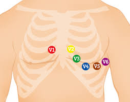 12 lead ecg placement guide with illustrations