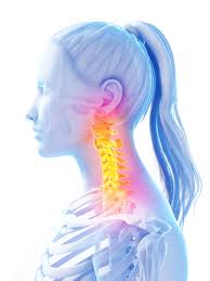 For those 48 hours, limit your movement and use a heat . Wry Neck The Back And Body Clinic Specialist Physiotherapy Northampton