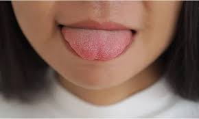 Image result for cancer tongue symptoms)