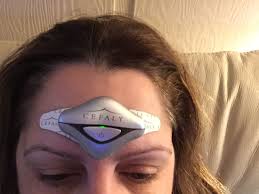 Cefaly 2 Trying This Device For My Chronic Migraines Did It First Time Yesterday It Feels Wild Will Take Time To Chronic Migraines Migraine Sleep Eye Mask