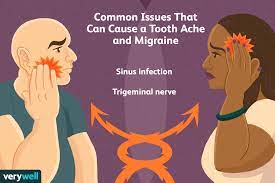 Oct 15, 2020 · i have had : The Link Between Your Headache And Toothache