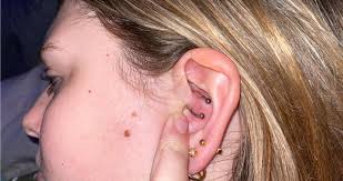 Hi guys, I think I have a bump forming