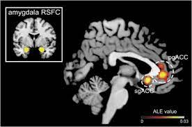 Mrs imaging (mrsi), which maps the spatial distributions of metabolites in the brain (posse et al., 2013) could overcome this limitation. You Say Prefrontal Cortex And I Say Anterior Cingulate Meta Analysis Of Spatial Overlap In Amygdala To Prefrontal Connectivity And Internalizing Symptomology Translational Psychiatry
