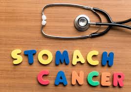 Stomach cancer symptoms can be easy to miss. Asianet Breaking News Kerala Local News Kerala Latest News Kerala Breaking News News