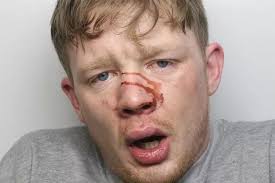 Police issue image of bloodied burglar wanted