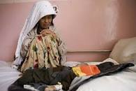 Resultado de imagen para site:www.who.int/es/ coronavirus "alimentación saludable"